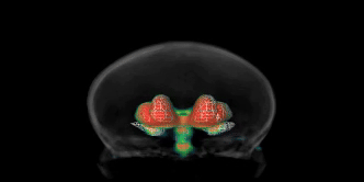 VMAT2 brain location
